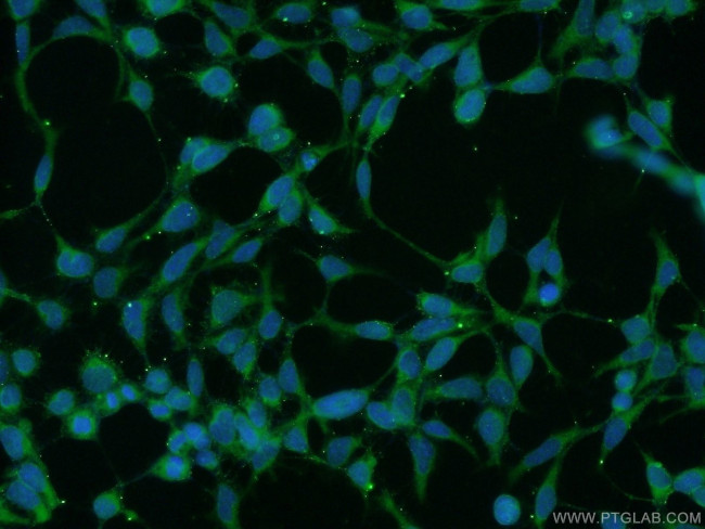 UBAC2 Antibody in Immunocytochemistry (ICC/IF)