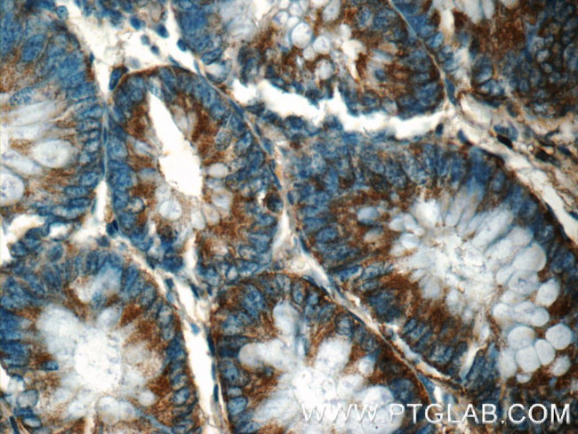 FIBCD1 Antibody in Immunohistochemistry (Paraffin) (IHC (P))