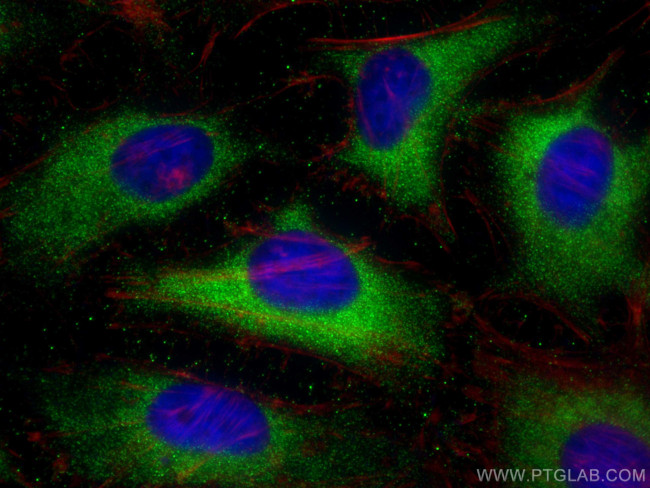Cleaved Caspase 3 Antibody in Immunocytochemistry (ICC/IF)