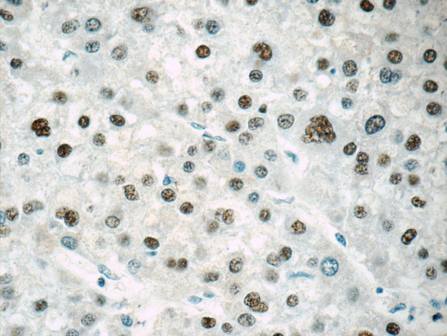 ONECUT1 Antibody in Immunohistochemistry (Paraffin) (IHC (P))