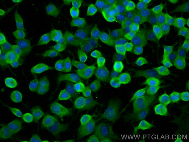 UBXN2B Antibody in Immunocytochemistry (ICC/IF)