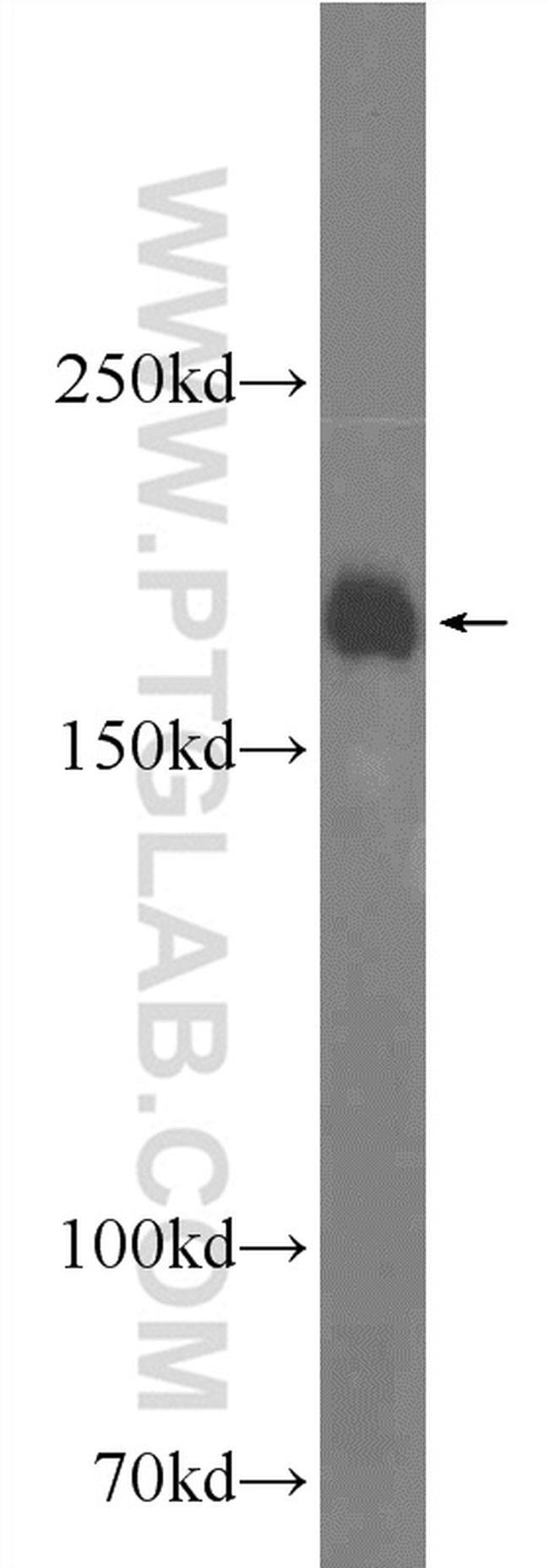 ARAP2 Antibody in Western Blot (WB)