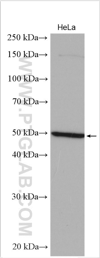 TBX15 Antibody in Western Blot (WB)