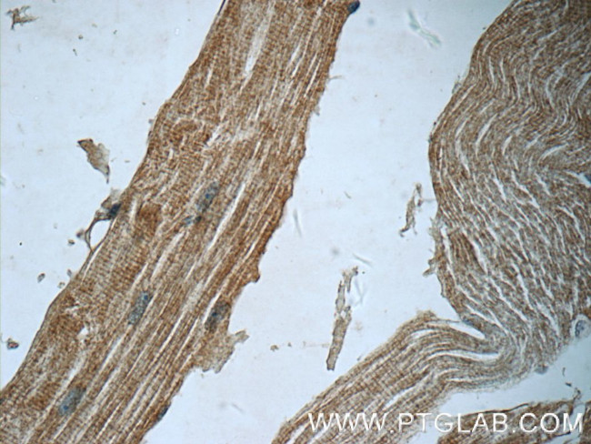 SYNC Antibody in Immunohistochemistry (Paraffin) (IHC (P))