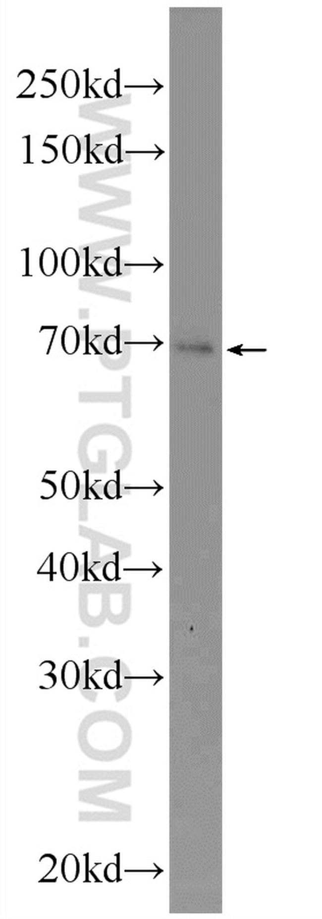 ZNF253 Antibody in Western Blot (WB)