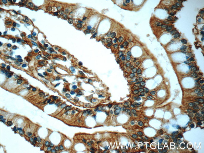 Annexin A13 Antibody in Immunohistochemistry (Paraffin) (IHC (P))