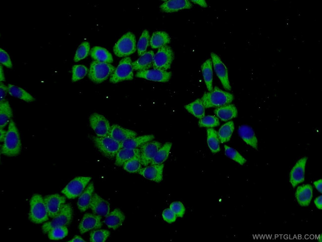 PROSC Antibody in Immunocytochemistry (ICC/IF)