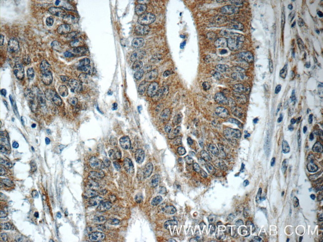 TMEM156 Antibody in Immunohistochemistry (Paraffin) (IHC (P))