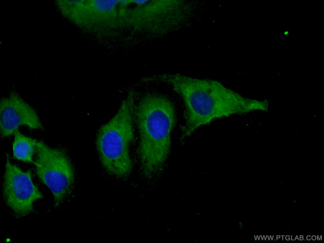 DNAJC18 Antibody in Immunocytochemistry (ICC/IF)