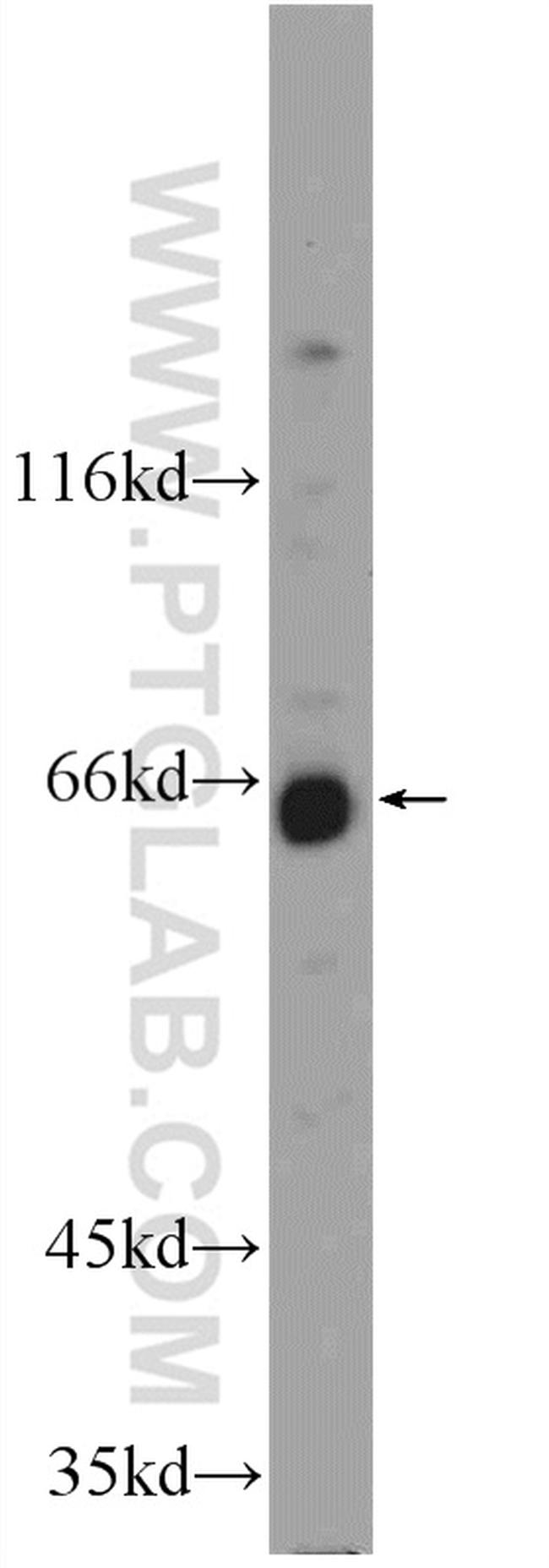 WDR20 Antibody in Western Blot (WB)