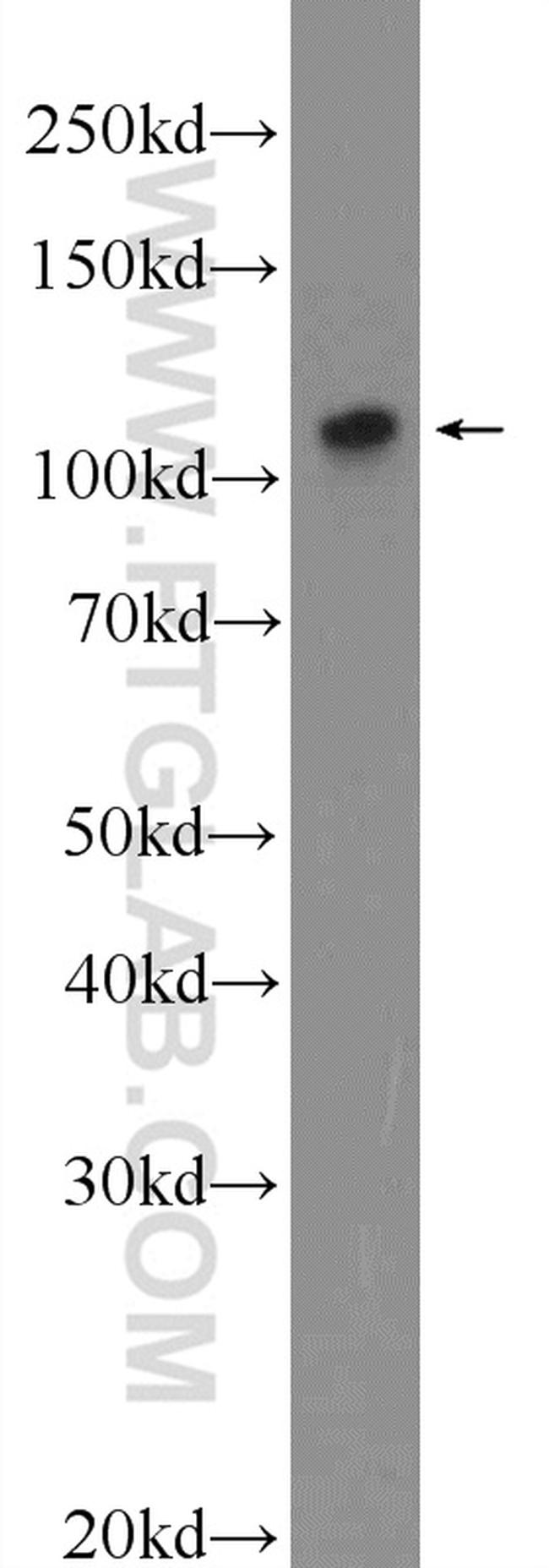 ZNF711 Antibody in Western Blot (WB)