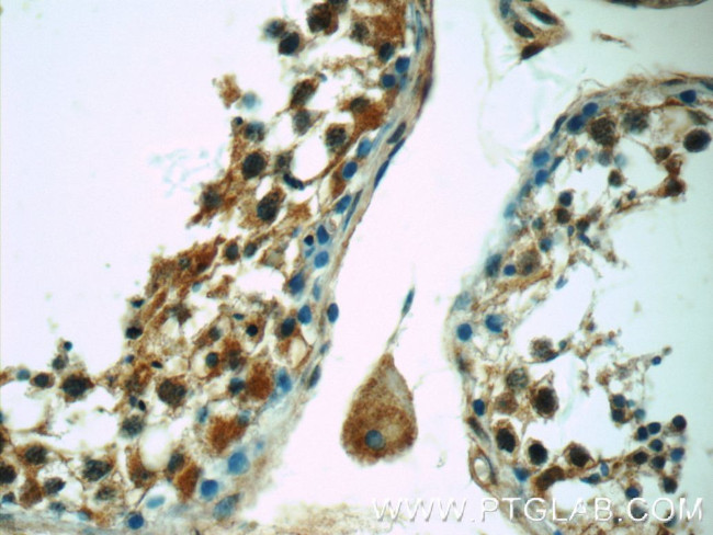C12orf54 Antibody in Immunohistochemistry (Paraffin) (IHC (P))
