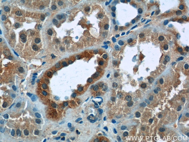ZNF497 Antibody in Immunohistochemistry (Paraffin) (IHC (P))