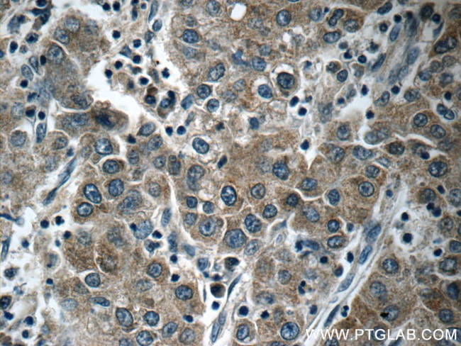 KIAA0125 Antibody in Immunohistochemistry (Paraffin) (IHC (P))