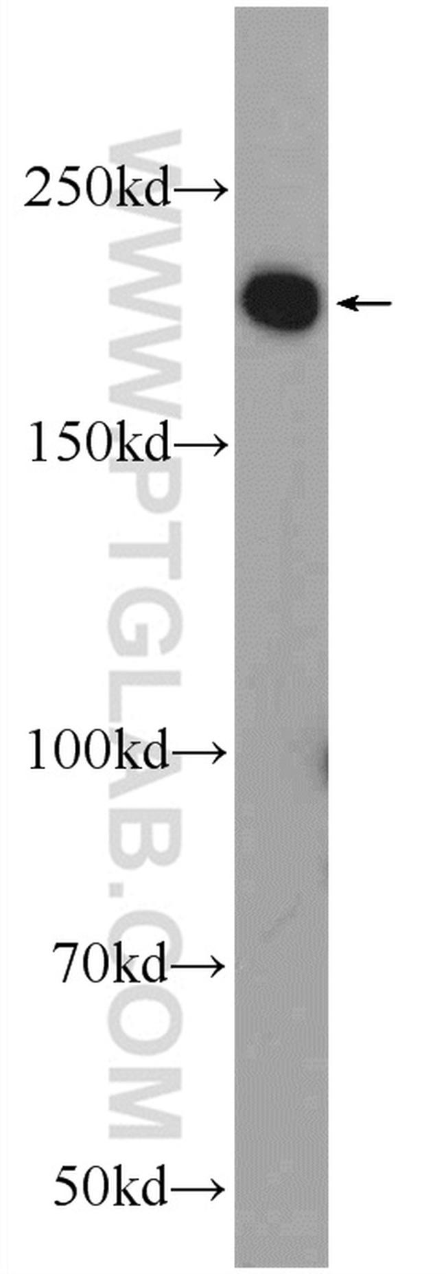 ZCCHC6 Antibody in Western Blot (WB)