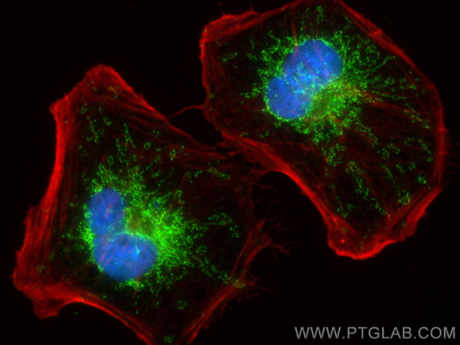 COA1 Antibody in Immunocytochemistry (ICC/IF)