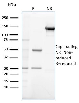 Gastrin Antibody in SDS-PAGE (SDS-PAGE)