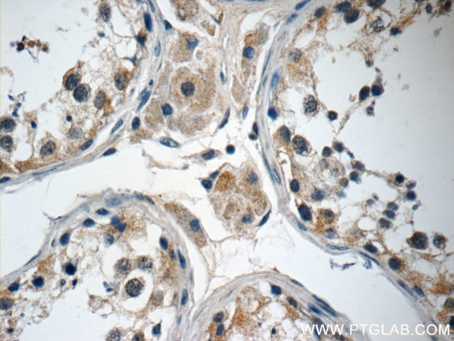 ANKRD33 Antibody in Immunohistochemistry (Paraffin) (IHC (P))