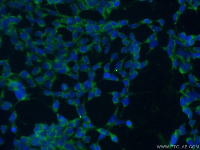 TXNDC9 Antibody in Immunocytochemistry (ICC/IF)