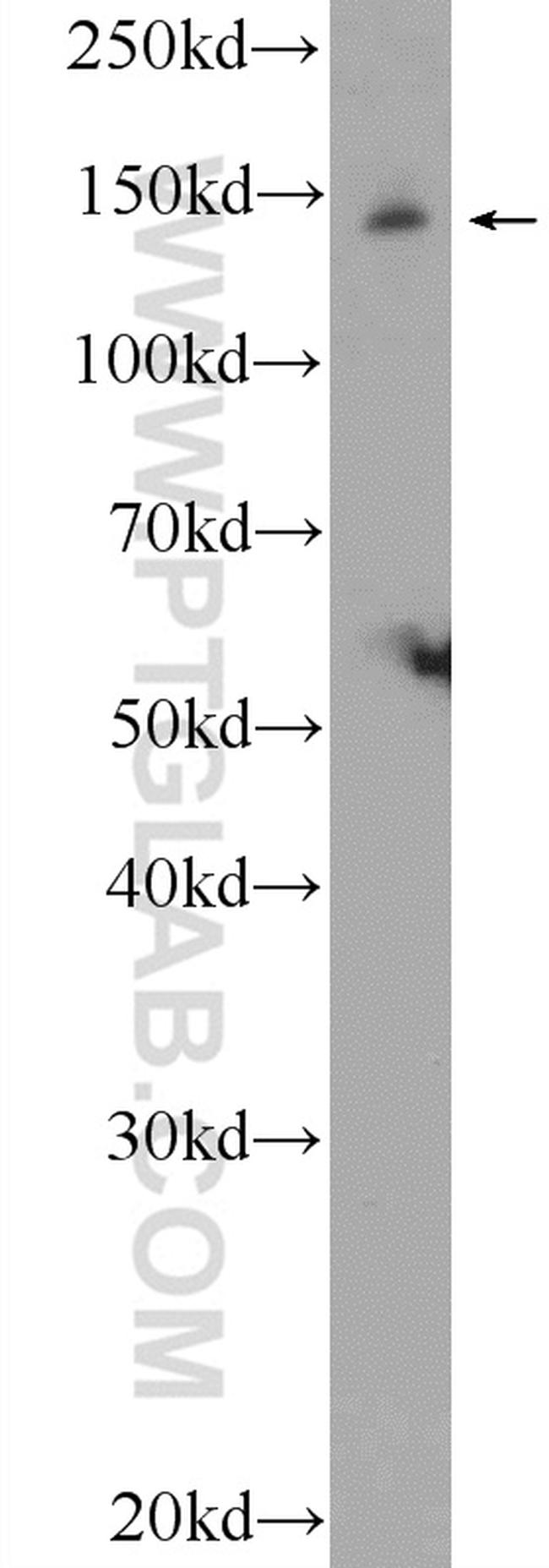 JIP3 Antibody in Western Blot (WB)