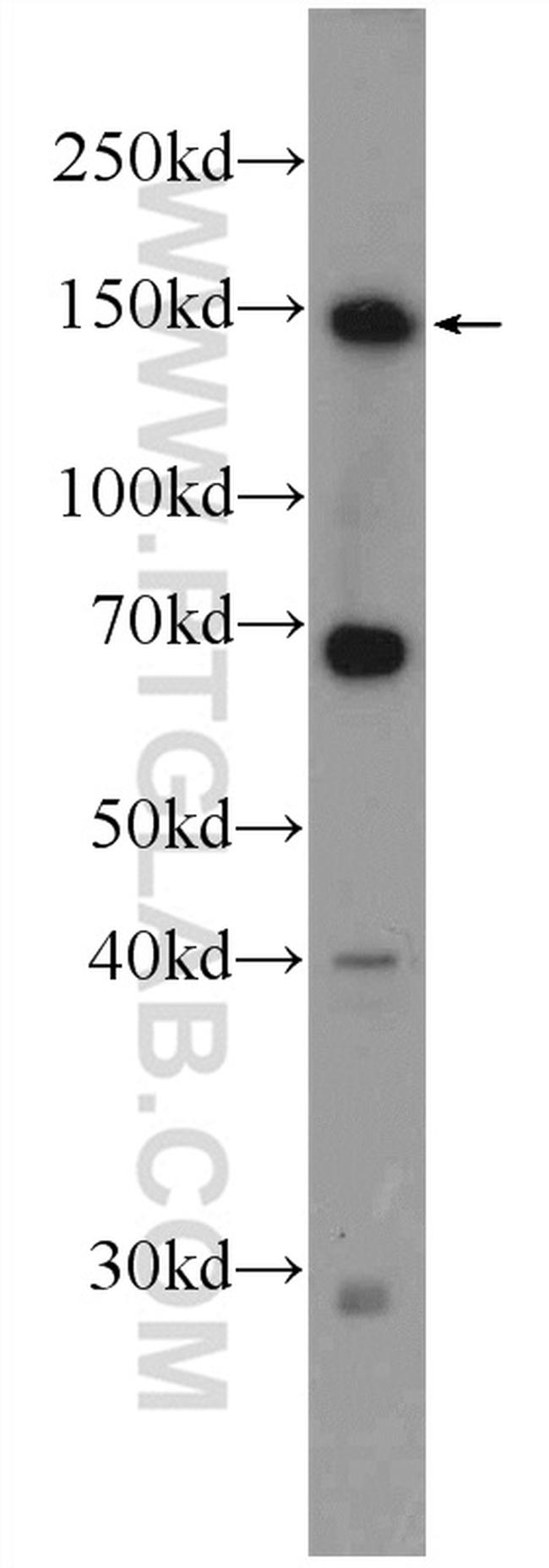 ZBTB11 Antibody in Western Blot (WB)
