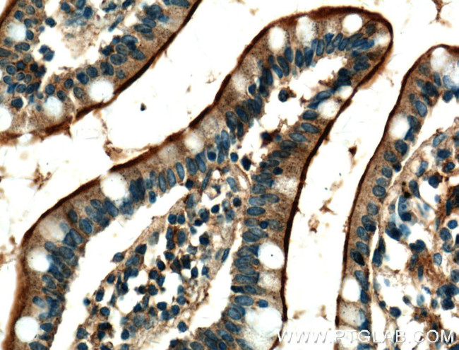 USE1 Antibody in Immunohistochemistry (Paraffin) (IHC (P))