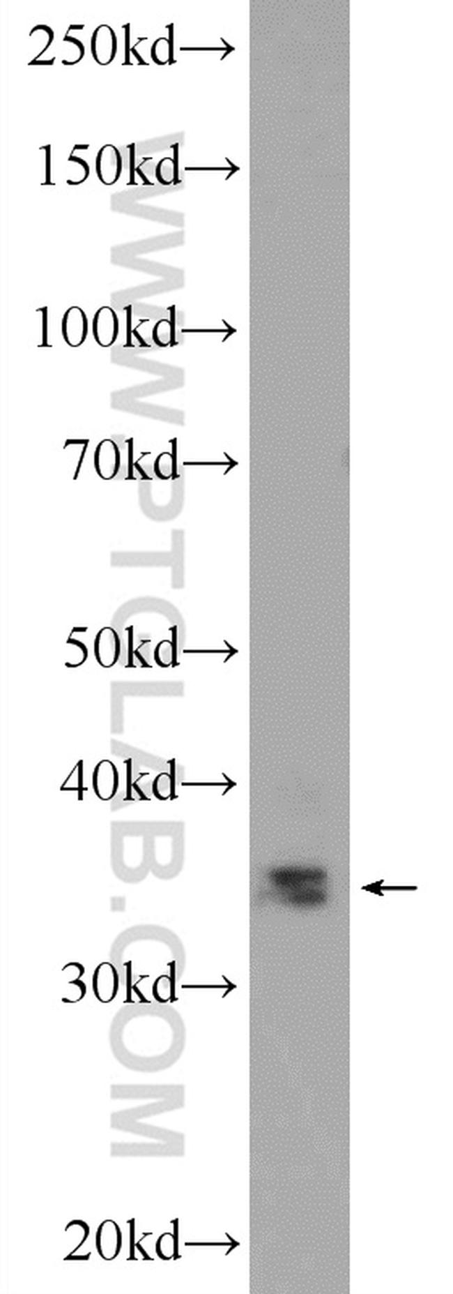SLMAP Antibody in Western Blot (WB)