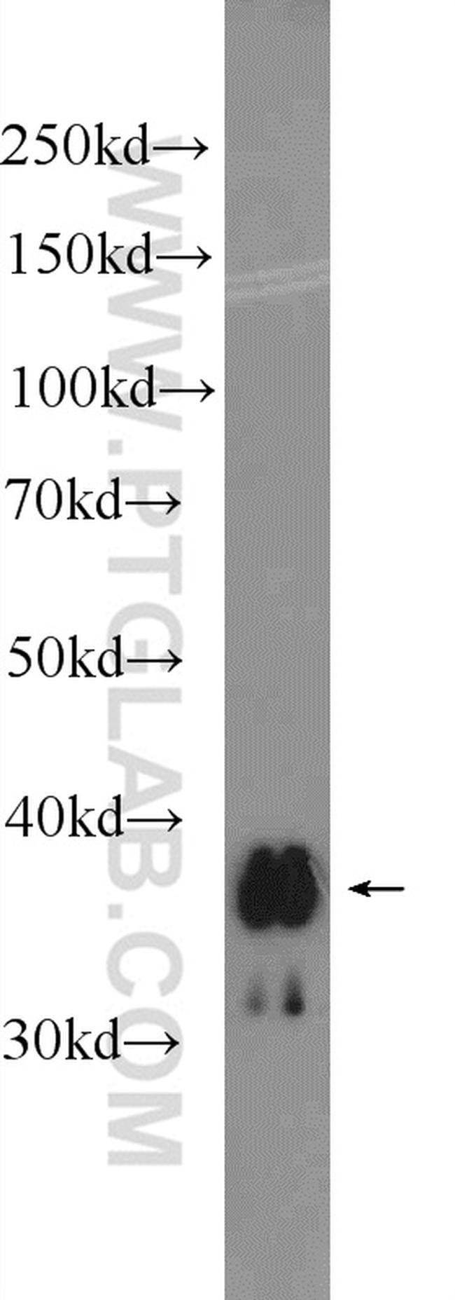 UCP5 Antibody in Western Blot (WB)