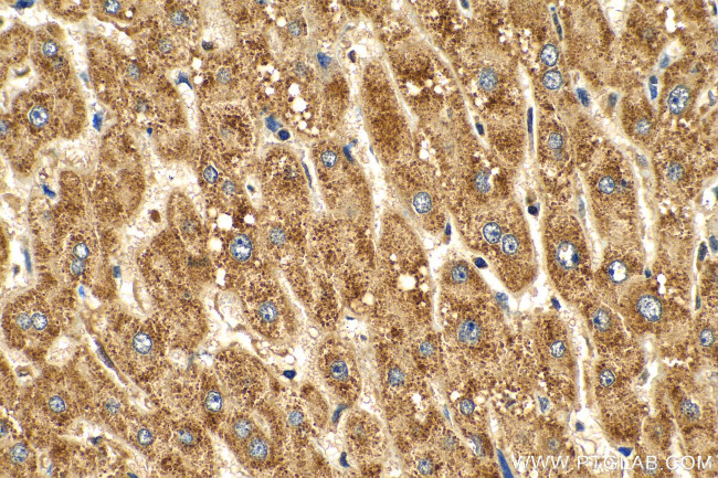 KLHL28 Antibody in Immunohistochemistry (Paraffin) (IHC (P))