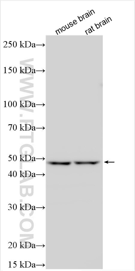 TRPA1 Antibody in Western Blot (WB)