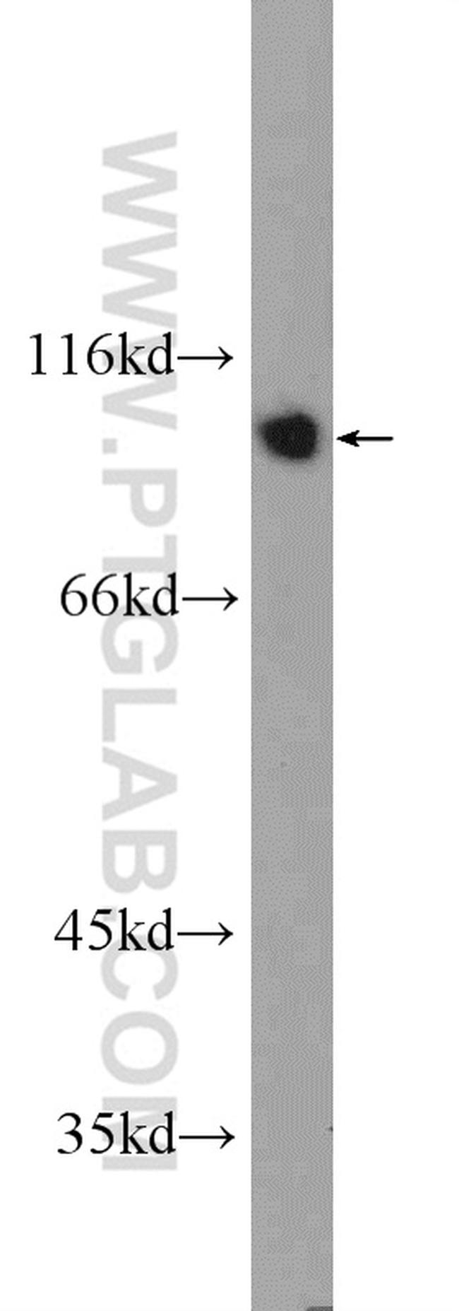 IFT80 Antibody in Western Blot (WB)