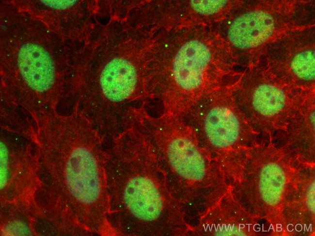 CCAR1 Antibody in Immunocytochemistry (ICC/IF)