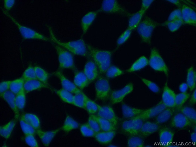 KIAA0430 Antibody in Immunocytochemistry (ICC/IF)