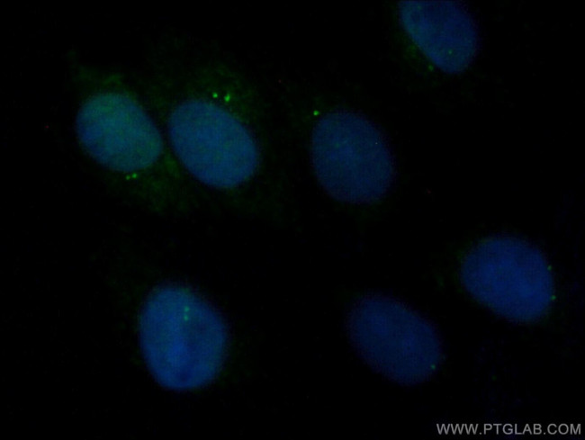 CEP110 Antibody in Immunocytochemistry (ICC/IF)