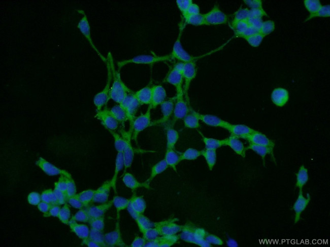 COMMD8 Antibody in Immunocytochemistry (ICC/IF)