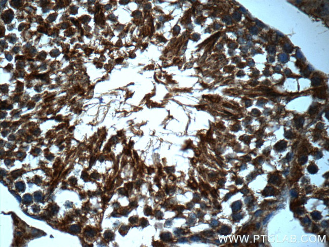 TDRD5 Antibody in Immunohistochemistry (Paraffin) (IHC (P))