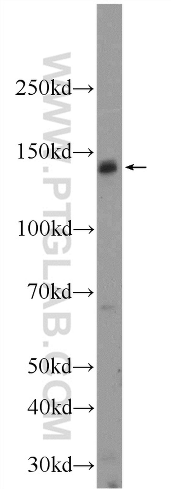 FNDC3A Antibody in Western Blot (WB)