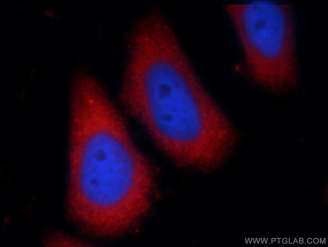 PHLPPL Antibody in Immunocytochemistry (ICC/IF)
