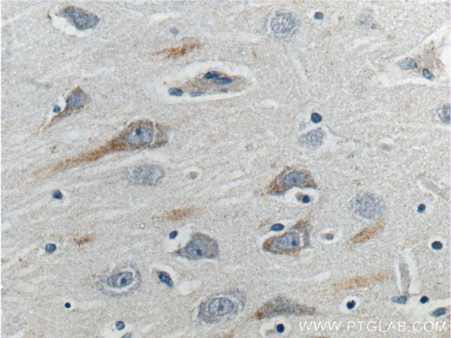 GPR103 Antibody in Immunohistochemistry (Paraffin) (IHC (P))