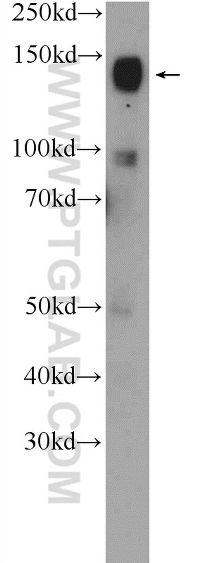 CHL1 Antibody in Western Blot (WB)