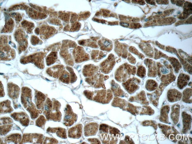 GUCY2F Antibody in Immunohistochemistry (Paraffin) (IHC (P))