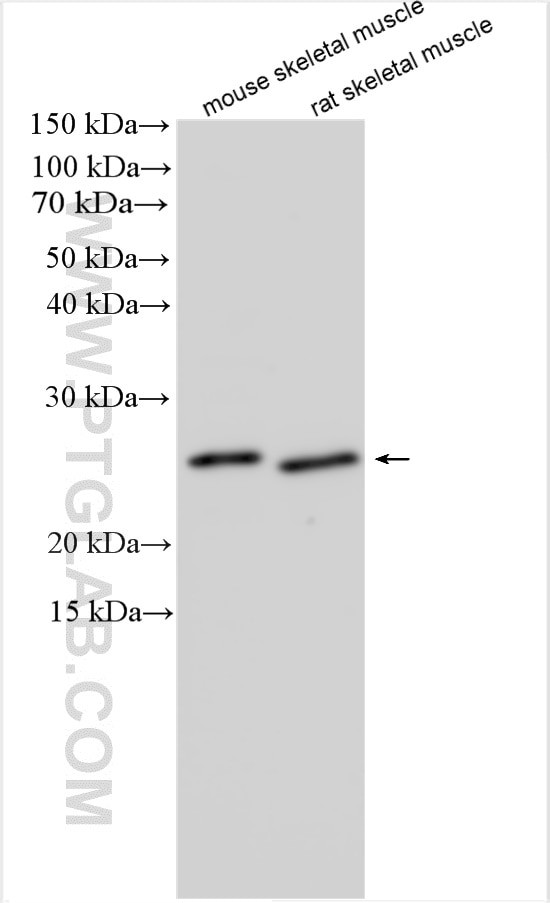 DUPD1/DUSP27 Antibody in Western Blot (WB)
