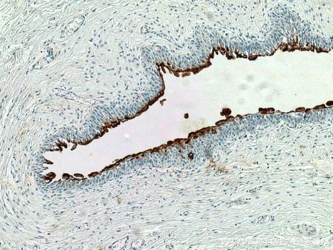 UPK1A Antibody in Immunohistochemistry (Paraffin) (IHC (P))
