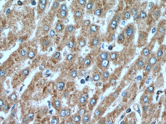 BEX5 Antibody in Immunohistochemistry (Paraffin) (IHC (P))