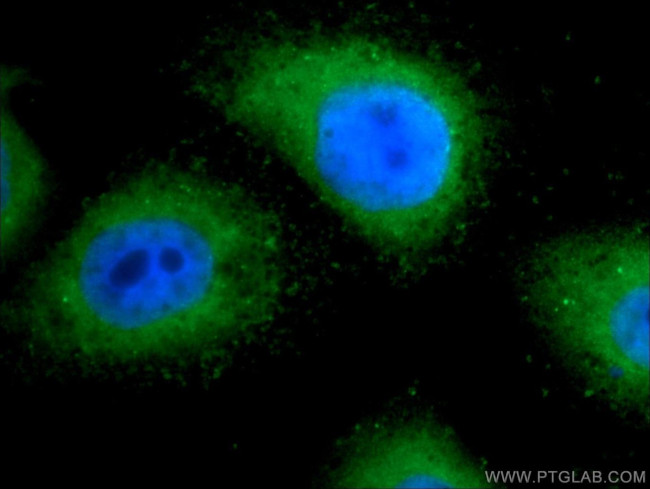 TRAPPC2L Antibody in Immunocytochemistry (ICC/IF)