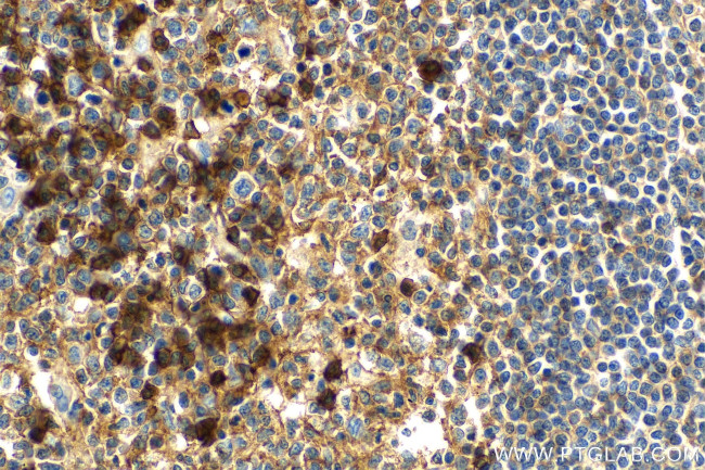 CD38 Antibody in Immunohistochemistry (Paraffin) (IHC (P))