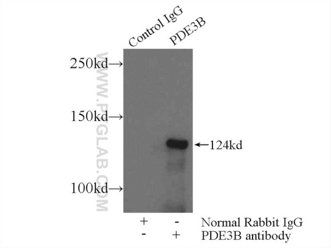 PDE3B Antibody in Immunoprecipitation (IP)