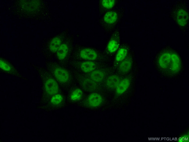 CWC15 Antibody in Immunocytochemistry (ICC/IF)