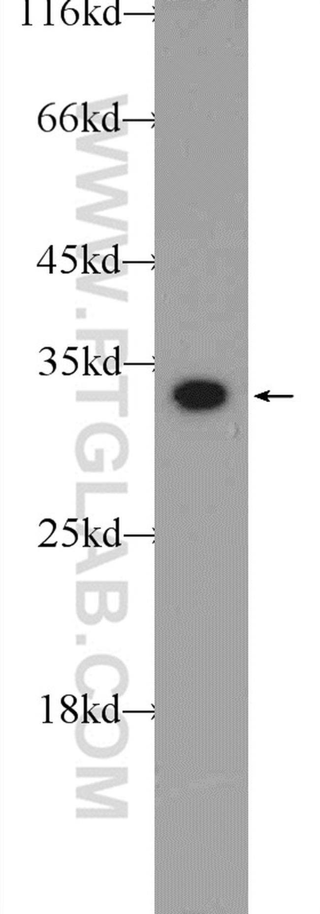 CWC15 Polyclonal Antibody (25293-1-AP)