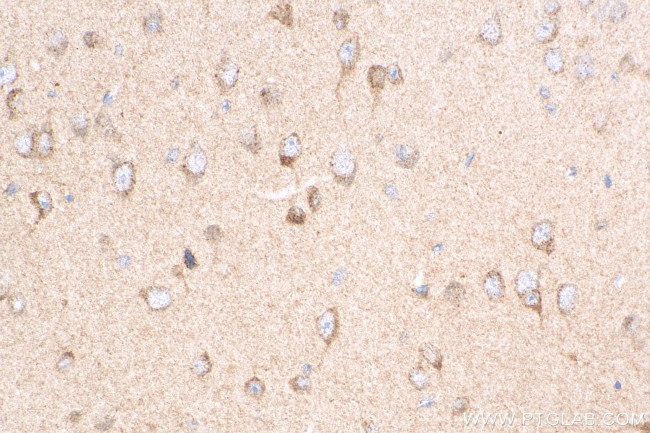 PPFIA4 Antibody in Immunohistochemistry (Paraffin) (IHC (P))